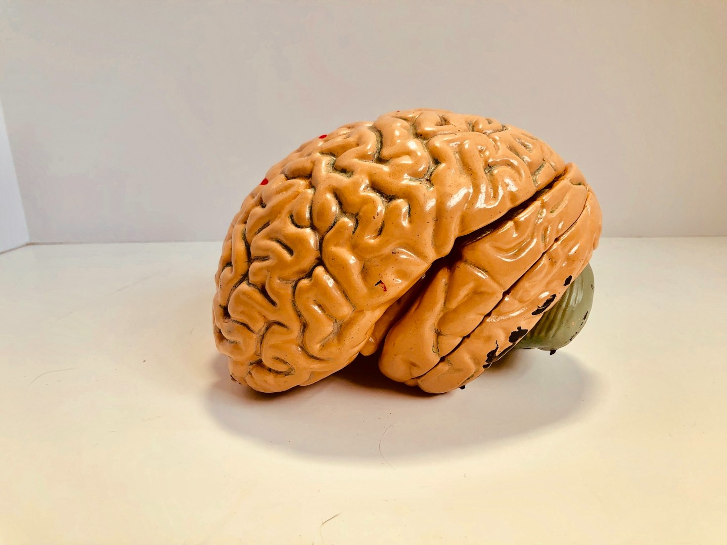 The Importance of Early Diagnosis in Brain Tumors