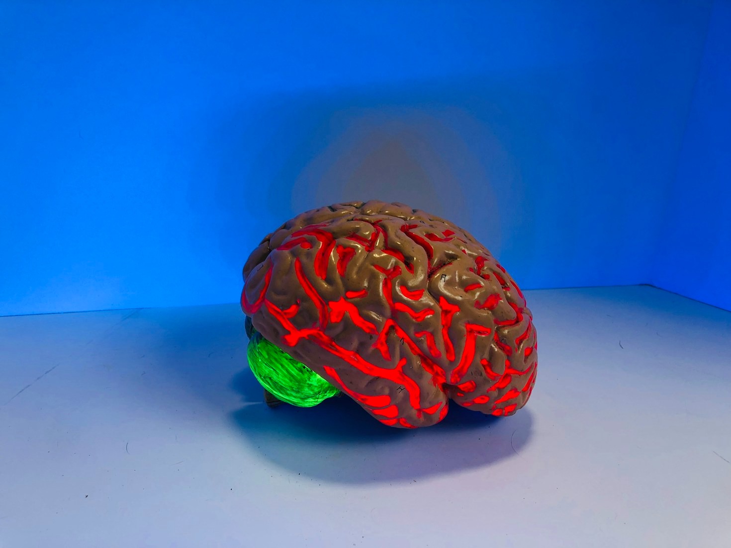 Understanding Brain Tumor Stages and Prognosis