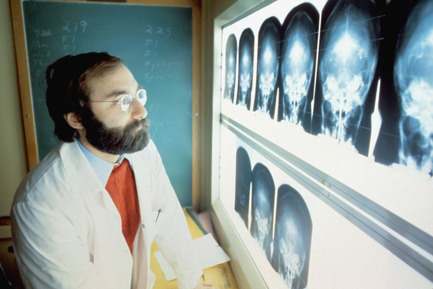 How Healthcare Pros Can Stay Updated on Brain Tumors